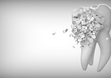 Боль в зубе: причины, виды, помощь