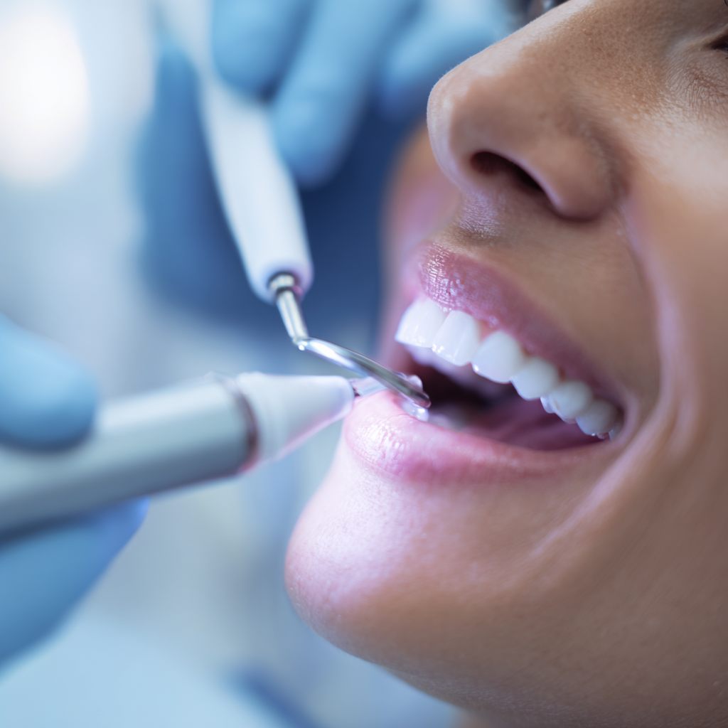 Аэр Фло для зубов - что это?